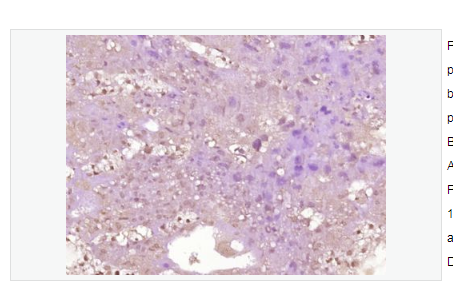 Anti-phospho-KLF5 antibody-磷酸化肠道内富含的Kruppel样因子5抗体,phospho-KLF5 (Ser311)