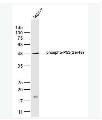 Anti-phospho-P53  antibody-磷酸化腫瘤抑制基因P53抗體,phospho-P53 (Ser46)