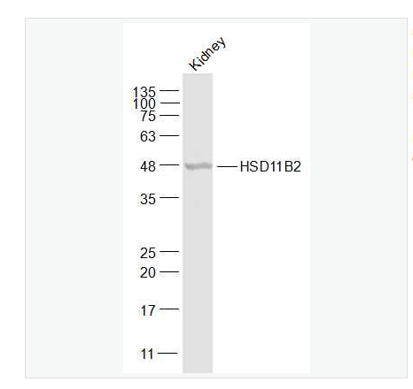 Anti-HSD11B2  antibody-羟基类固醇脱氢酶11β2抗体,HSD11B2