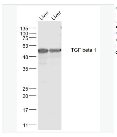 Anti-TGF beta 1  antibody-转化生长因子β1/TGF β1/TGF-β1抗体,TGF beta 1