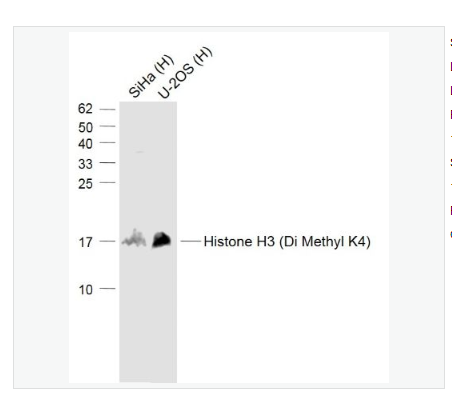 Anti-Histone H3  antibody-二甲基化组蛋白H3K4抗体,Histone H3 (Di Methyl K4)