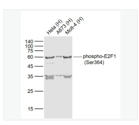 Anti-phospho-AKT1+AKT2+AKT3  antibody   -磷酸化蛋白激酶AKT1,2,3抗体,phospho-AKT1+AKT2+AKT3 (Tyr315+316+312)