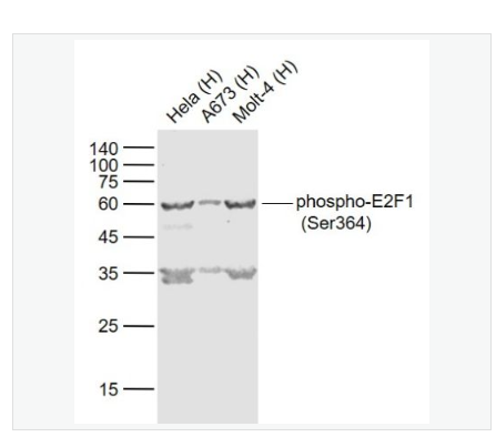 Anti-phospho-E2F1 (Ser364) antibody   -磷酸化转录因子E2F-1抗体,phospho-E2F1 (Ser364)