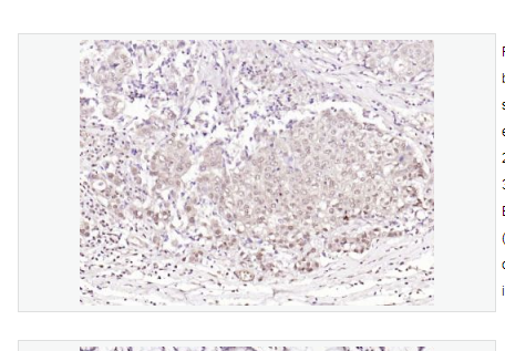 Anti-phospho-BRAF antibody   -磷酸化B-Raf抗体,phospho-BRAF (Thr401)