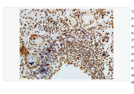 Anti-phospho-CDKN1A/p21  antibody   -磷酸化p21蛋白抗体,phospho-CDKN1A/p21 (Thr57)