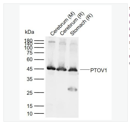 Anti-PTOV1 antibody   -前列腺肿瘤高表达蛋白1抗体,PTOV1