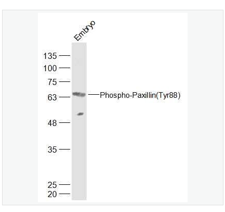 Anti-Phospho-Paxillin antibody   -磷酸化桩蛋白Paxillin抗体,Phospho-Paxillin (Tyr88)