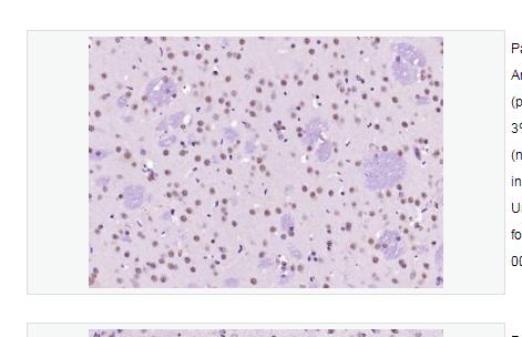 Anti-SOX9 antibody   -转录因子SOX9蛋白抗体,SOX9