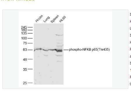 Anti-phospho-NFKB p65 antibody   -磷酸化细胞核因子抗体,phospho-NFKB p65 (Thr435)