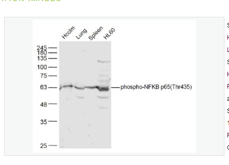 Anti-phospho-NFKB p65 antibody   -磷酸化細(xì)胞核因子抗體,phospho-NFKB p65 (Thr435)