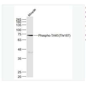 Anti-Phospho-TAK1antibody-磷酸化转化生长因子β活化激酶1