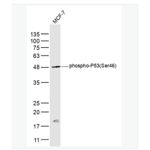Anti-phospho-P53  antibody-磷酸化肿瘤抑制基因P53抗体,phospho-P53 (Ser46)