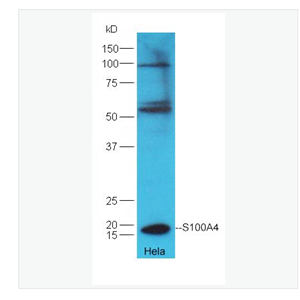 Anti-S100A4  antibody-FSP-1抗体