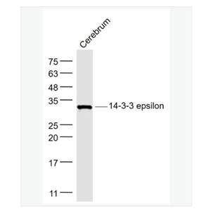 Anti-14-3-3 epsilon   antibody-14-3-3E蛋白抗体