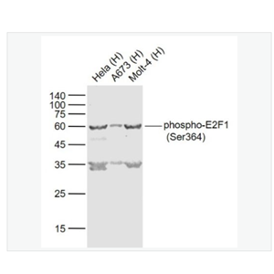 Anti-phospho-AKT1+AKT2+AKT3  antibody   -磷酸化蛋白激酶AKT1,2,3抗体,phospho-AKT1+AKT2+AKT3 (Tyr315+316+312)