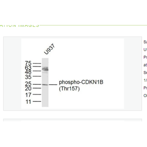 Anti-phospho-CDKN1B antibody   -磷酸化P27抗体/周期素依赖激酶抑制剂抗体