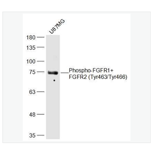 Anti-Phospho-FGFR1+FGFR2 antibody   -磷酸化碱性成纤维细胞生长因子受体1/2（CD331/CD332）抗体,Phospho-FGFR1+FGFR2 (Tyr463/Tyr466)