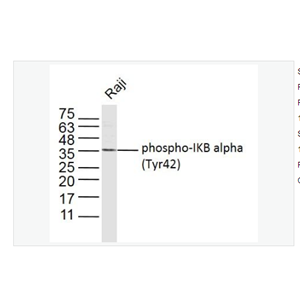 Anti-phospho-IKB alpha antibody   -磷酸化IKB α抗体