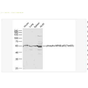 Anti-phospho-NFKB p65 antibody   -磷酸化细胞核因子抗体,phospho-NFKB p65 (Thr435)