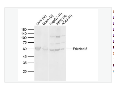 Anti-Frizzled 5 antibody   -Wnt信號(hào)受體蛋白抗體,Frizzled 5