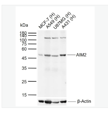 Anti-AIM2 antibody   -干扰素诱导蛋白AIM2抗体,AIM2