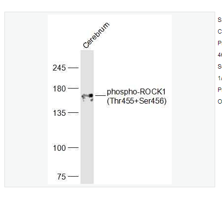 Anti-phospho-ROCK1 antibody   -磷酸化Rho相关蛋白激酶1抗体,phospho-ROCK1 (Thr455+Ser456)