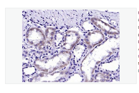 Anti-ALAS1 antibody   -5-氨基乙酰丙酸合酶1抗体,ALAS1