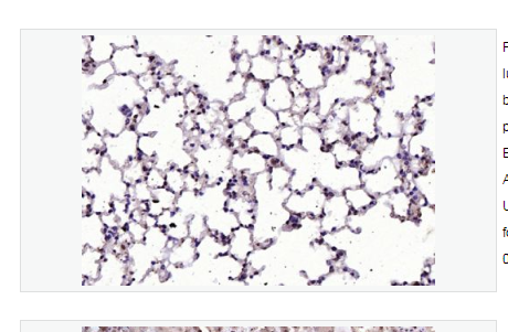 Anti-RGC32/C13orf15 antibody   -补体应答基因32抗体,RGC32/C13orf15