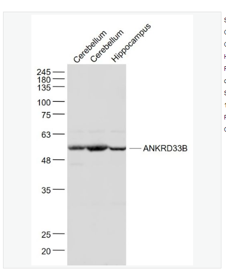 Anti-ANKRD33B antibody  -锚蛋白重复结构域蛋白33B抗体,ANKRD33B