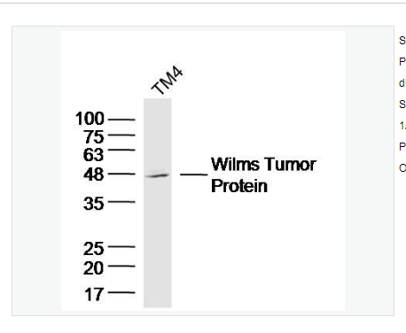 Anti-WT1 antibody  -腎母細(xì)胞瘤蛋白抗體,WT1