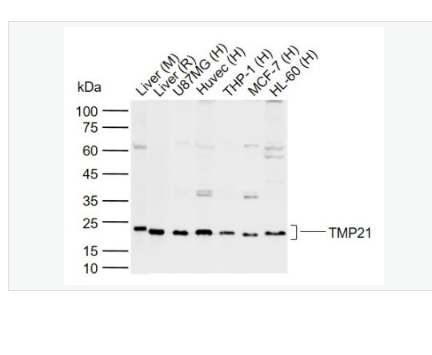 Anti-TMP21 antibody  -跨膜轉(zhuǎn)運蛋白21抗體,TMP21