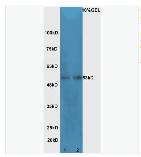 Anti-Cdc25C antibody  -细胞分裂周期蛋白25C抗体,Cdc25C