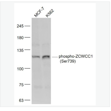 Anti-phospho-ZCWCC1 antibody  -磷酸化ZCWCC1抗体,phospho-ZCWCC1 (Ser739)