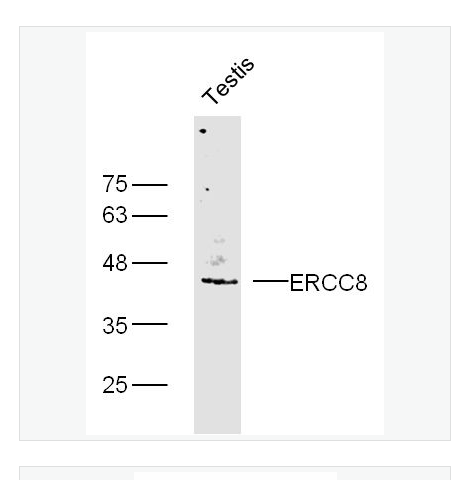 Anti-ERCC8 antibody  -科凯恩氏综合症相关蛋白/早衰蛋白CSA抗体,ERCC8