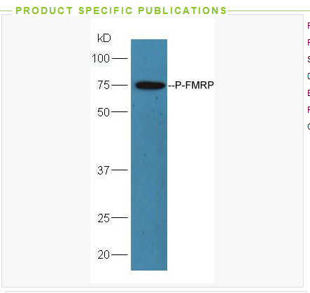 Anti-phospho-FMRP  antibody  -磷酸化脆性X综合征相关蛋白AFF1抗体,phospho-FMRP (Ser500)