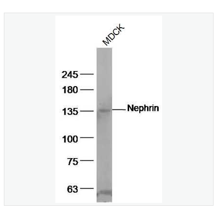 Anti-Nephrin antibody  -肾小球细胞粘附分子受体抗体,Nephrin