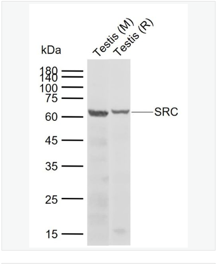 Anti-SRC antibody  -Src原癌基因抗体,SRC