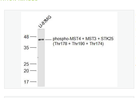 Anti-phospho-MST4 + MST3 + STK25 antibody  -磷酸化丝氨酸/苏氨酸蛋白激酶MST4,MST3,STK25抗体,phospho-MST4 + MST3 + STK25 (Thr178 + Thr190 + Thr174)