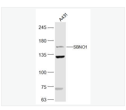 Anti-SBNO1antibody  -SBNO1蛋白抗体,SBNO1