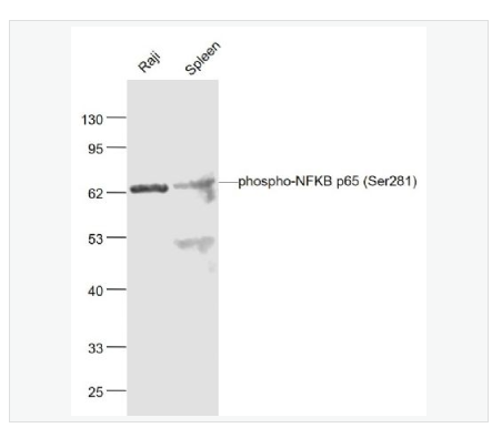 Anti-phospho-NFKB p65 antibody  -磷酸化细胞核因子抗体,phospho-NFKB p65 (Ser281)