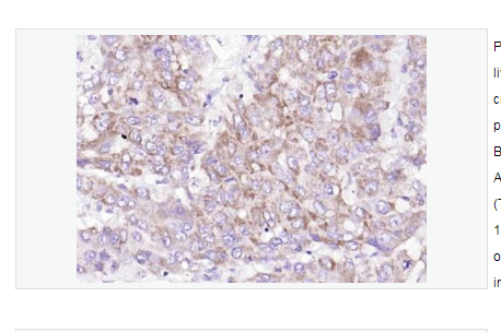 Anti-phospho-LIM Kinase 1 antibody  -磷酸化单丝氨酸蛋白激酶1抗体,phospho-LIM Kinase 1 (Thr508)