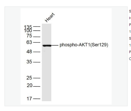 Anti-phospho-AKT1antibody  -磷酸化蛋白激酶B抗体,phospho-AKT1 (Ser129)