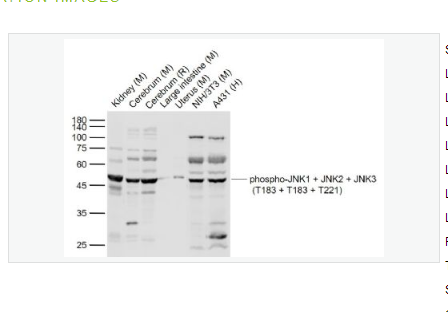 Anti-phospho-JNK1 + JNK2 + JNK3antibody  -磷酸化氨基末端激酶1/2/3抗体,phospho-JNK1 + JNK2 + JNK3 (T183 + T183 + T221)