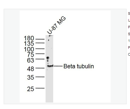 Anti-Beta tubulinantibody  -微管蛋白β tubulin/Tubulin β抗体,Beta tubulin