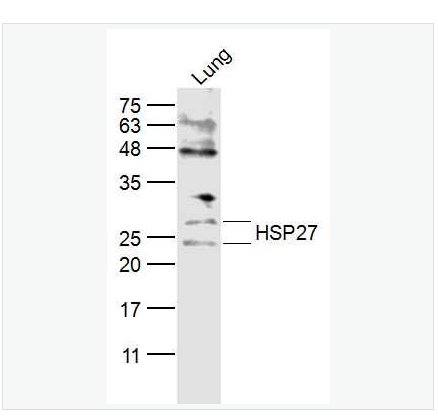 Anti-HSP27  antibody  -热休克蛋白27抗体,HSP27