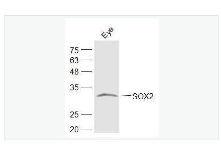 Anti-SOX2  antibody  -胚胎干细胞关键蛋白抗体,SOX2