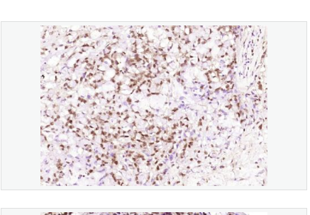 Anti-Ki-67 antibody  -Ki67蛋白單克隆抗體,Ki-67