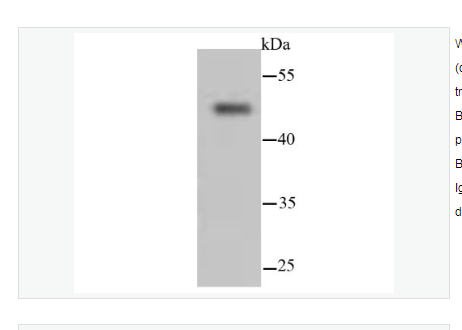 Anti-Cytokeratin 13 antibody  -细胞角蛋白13重组兔单克隆抗体,Cytokeratin 13