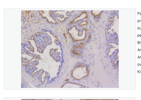 Anti-Cytokeratin 17 antibody  -细胞角蛋白17重组兔单克隆抗体,Cytokeratin 17