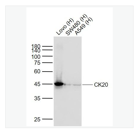 Anti-CK2 antibody  -细胞角蛋白20重组兔单克隆抗体,CK20